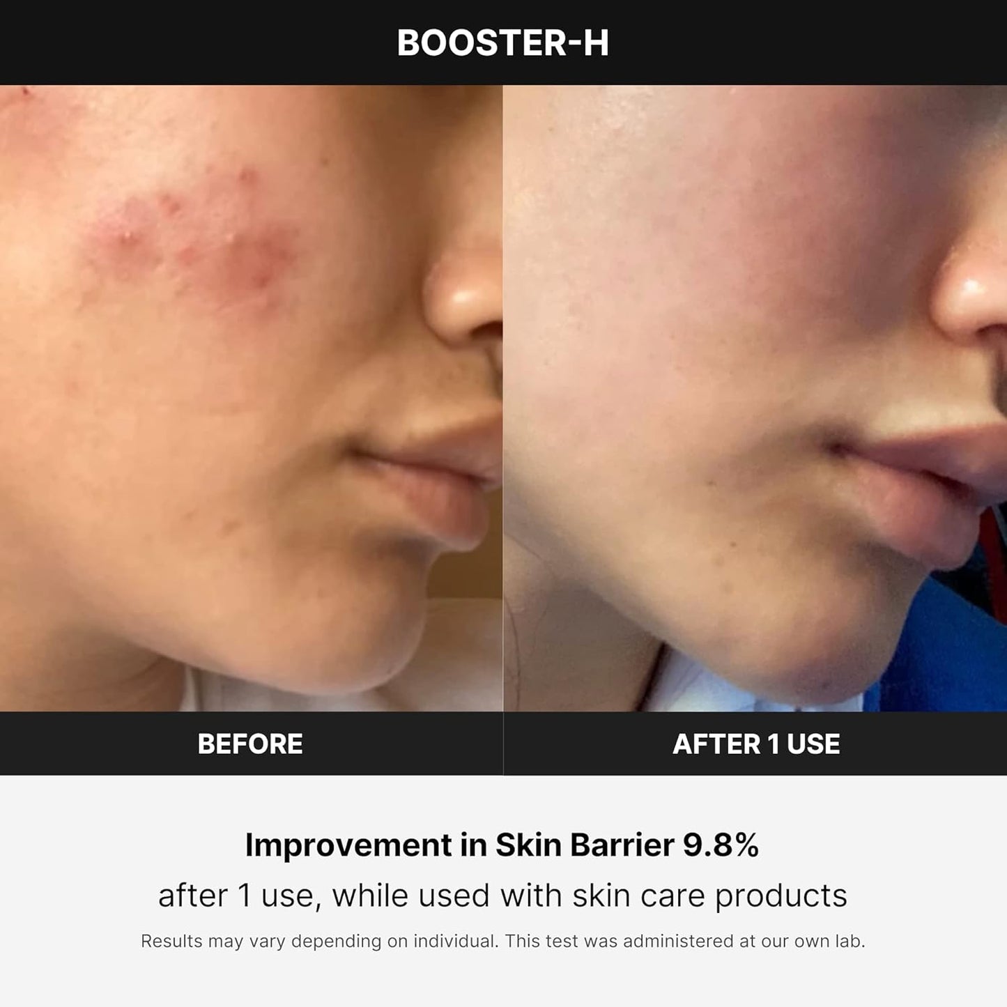 Medicube Age-R Booster Pro | 6-in-1 Real Glass Glow Device | Looking Glass Skin with Enhanced Absorption, Radiance, Elasticity,Pore Care | LED Anti-Wrinkle Device | Korean Skin Care