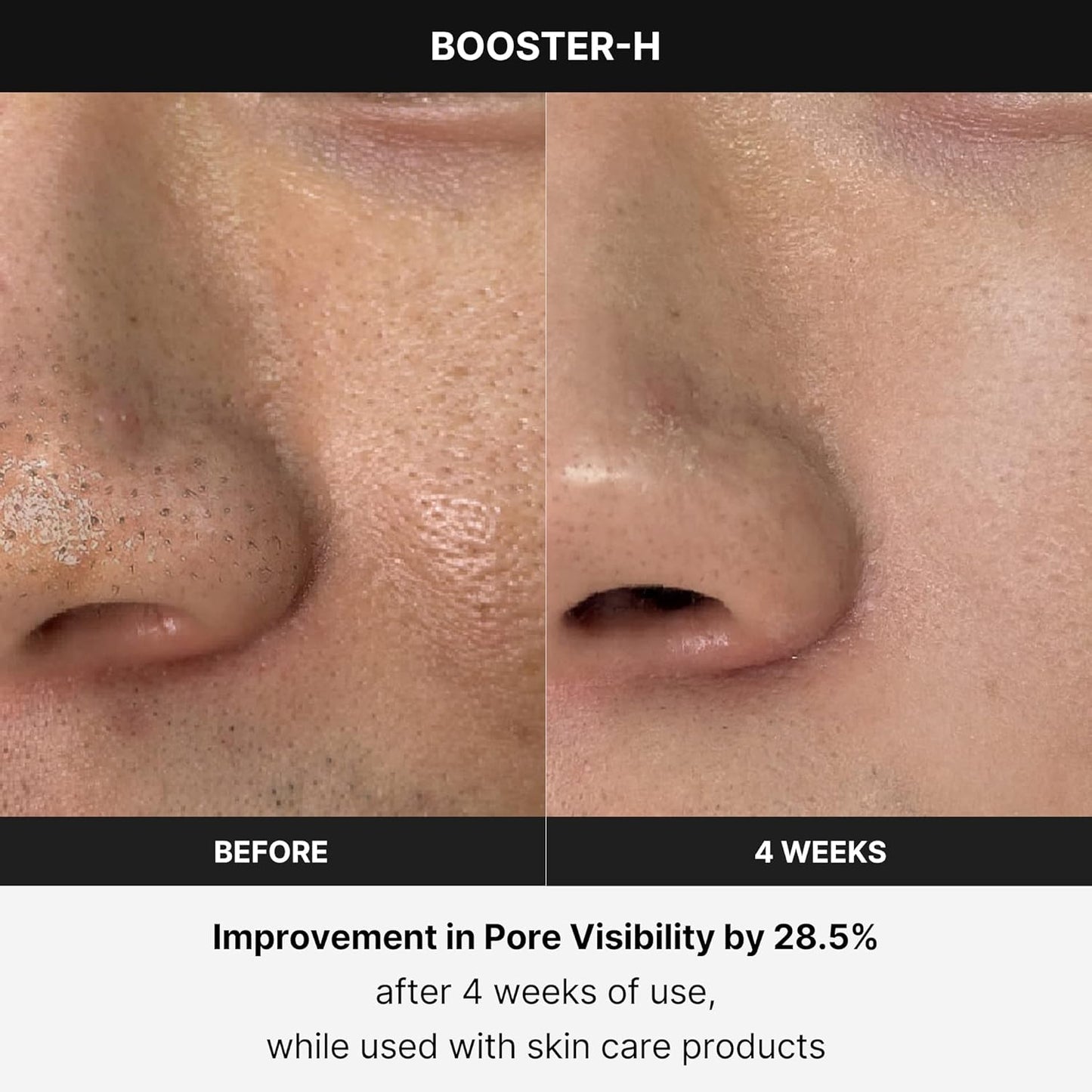 Medicube Age-R Booster Pro | 6-in-1 Real Glass Glow Device | Looking Glass Skin with Enhanced Absorption, Radiance, Elasticity,Pore Care | LED Anti-Wrinkle Device | Korean Skin Care