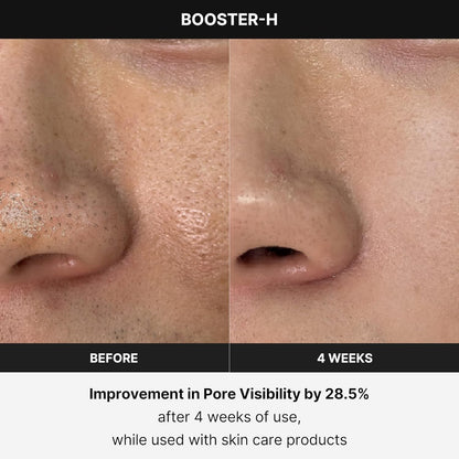 Medicube Age-R Booster Pro | 6-in-1 Real Glass Glow Device | Looking Glass Skin with Enhanced Absorption, Radiance, Elasticity,Pore Care | LED Anti-Wrinkle Device | Korean Skin Care
